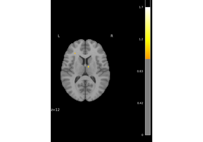 Massively univariate analysis of a motor task from the Localizer dataset