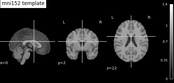 ../../_images/nilearn-plotting-plot_anat-1.png