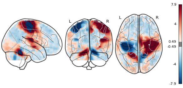 ../../_images/nilearn-plotting-plot_glass_brain-1.png