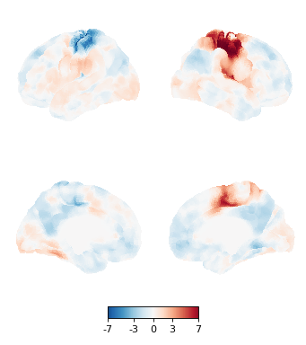 ../../_images/nilearn-plotting-plot_img_on_surf-1.png