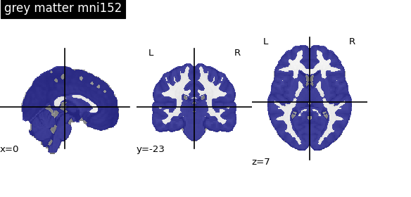 ../../_images/nilearn-plotting-plot_roi-1.png