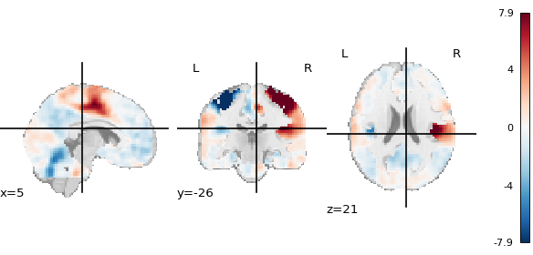 ../../_images/nilearn-plotting-plot_stat_map-1.png