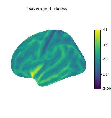 ../../_images/nilearn-plotting-plot_surf-1.png