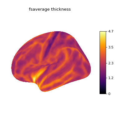 ../../_images/nilearn-plotting-plot_surf_stat_map-1.png