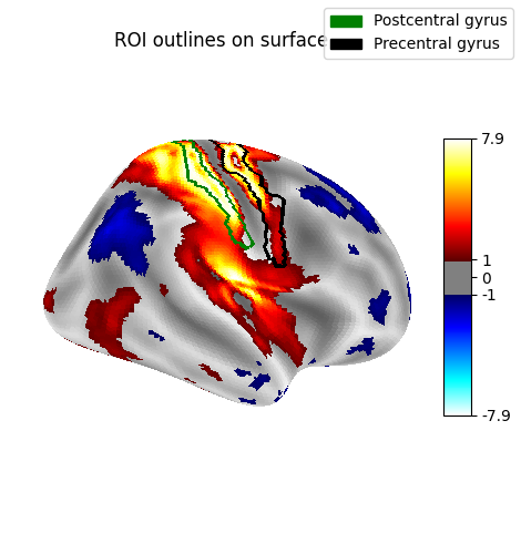 ROI outlines on surface