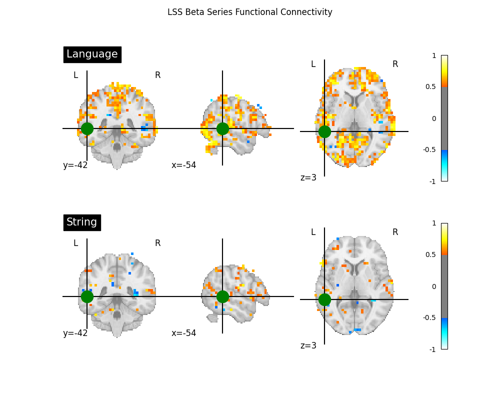 LSS Beta Series Functional Connectivity