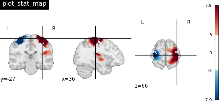 plot_stat_map
