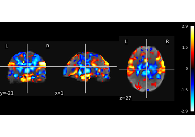 Multivariate decompositions: Independent component analysis of fMRI