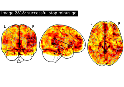 NeuroVault meta-analysis of stop-go paradigm studies.