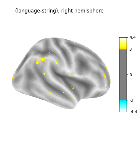 (language-string), right hemisphere