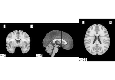 Basic nilearn example: manipulating and looking at data