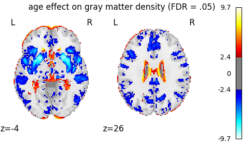 age effect on gray matter density (FDR = .05)