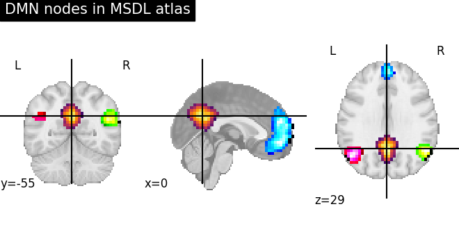 ../_images/sphx_glr_plot_overlay_001.png