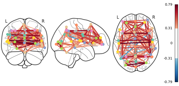 ../_images/sphx_glr_plot_probabilistic_atlas_extraction_002.png