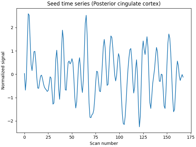 Seed time series (Posterior cingulate cortex)