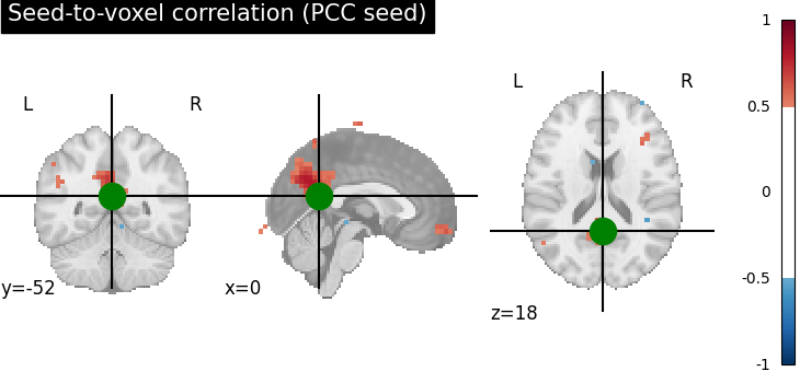 plot seed to voxel correlation