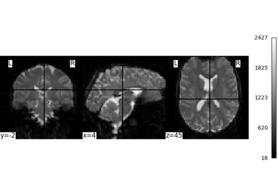 Intro to GLM Analysis: a single-run, single-subject fMRI dataset