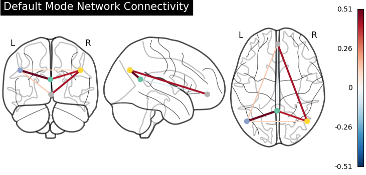 plot sphere based connectome