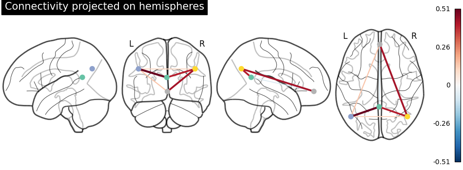 plot_connectome