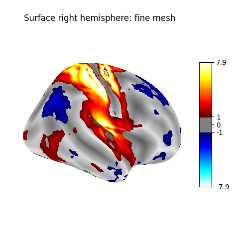 Surface right hemisphere: fine mesh