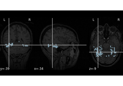 A introduction tutorial to fMRI decoding