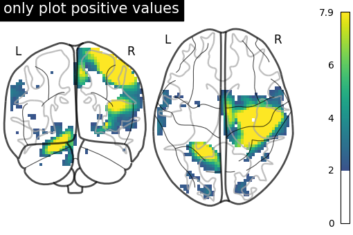 plot demo glass brain extensive