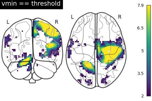 plot demo glass brain extensive