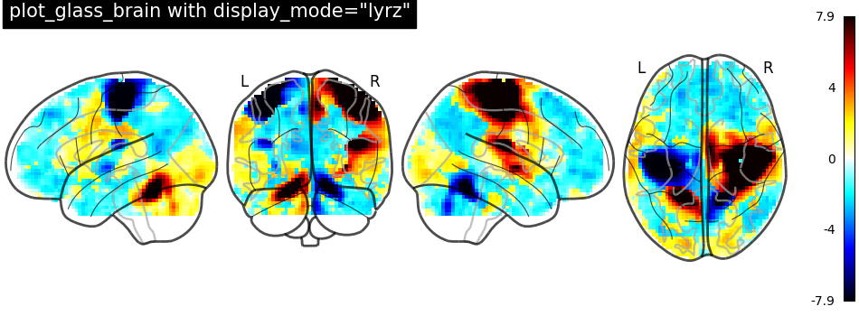 plot demo glass brain extensive