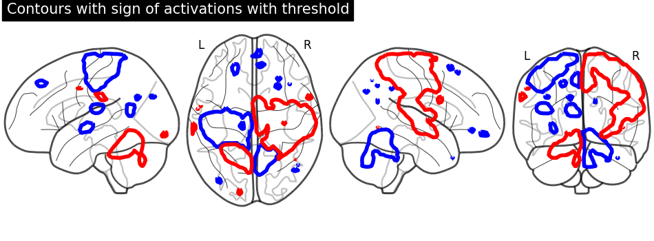 plot demo glass brain extensive