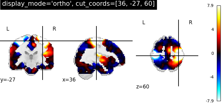 plot_ortho