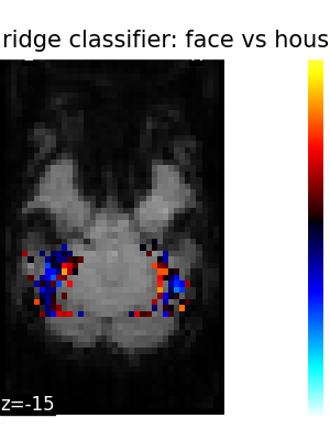 ../_images/sphx_glr_plot_haxby_different_estimators_004.png