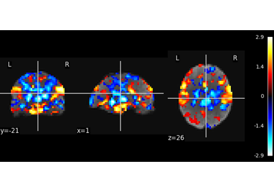 Multivariate decompositions: Independent component analysis of fMRI