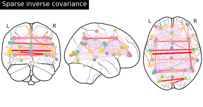 _images/sphx_glr_plot_inverse_covariance_connectome_004.png