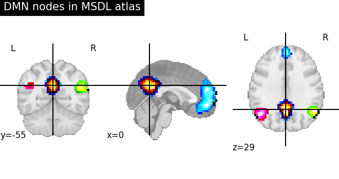 ../_images/sphx_glr_plot_overlay_001.png