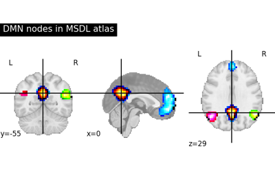 Visualizing a probabilistic atlas: the default mode in the MSDL atlas