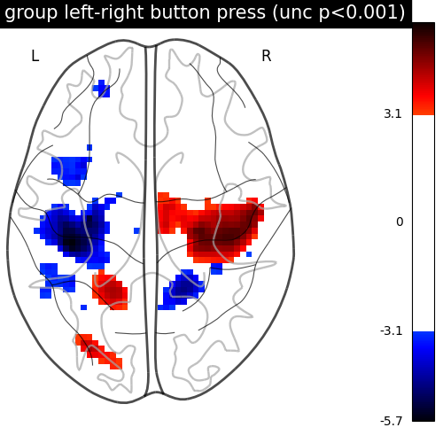 plot second level one sample test