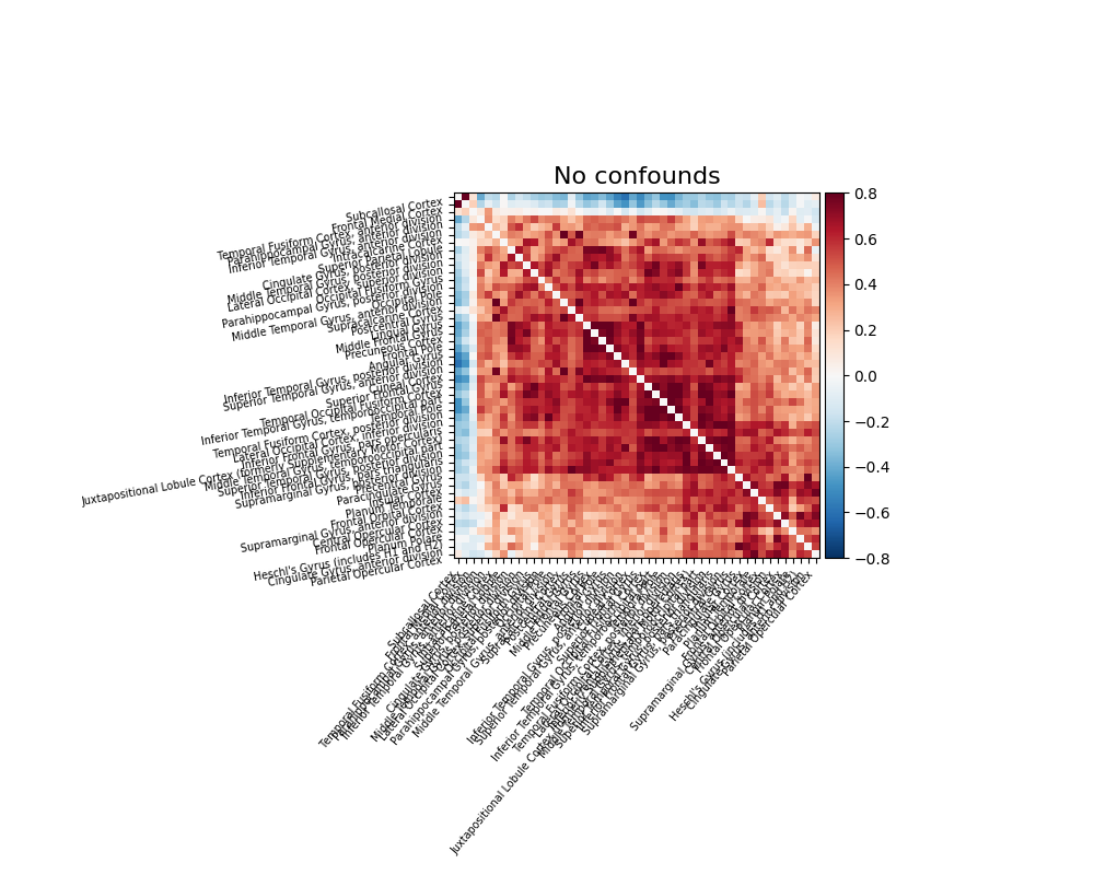 ../_images/sphx_glr_plot_signal_extraction_002.png