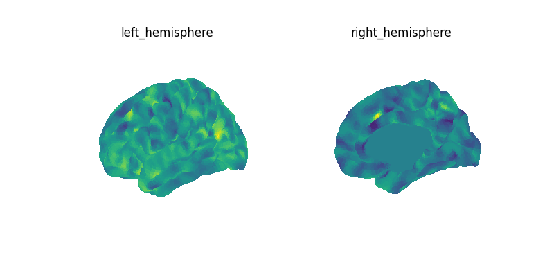 left_hemisphere, right_hemisphere